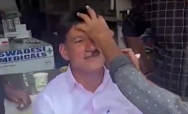 ಕೇರಳ ಲೋಕಲ್ ಫೈಟ್; ಪಣದಲ್ಲಿ ಸೋತು ಮೀಸೆ ಬೋಳಿಸಿದ LDF ನಾಯಕ